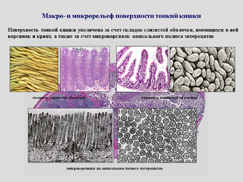 Макро- и микрорельеф поверхности тонкий кишки Поверхность тонкой кишки увеличена за счет складок слизистой